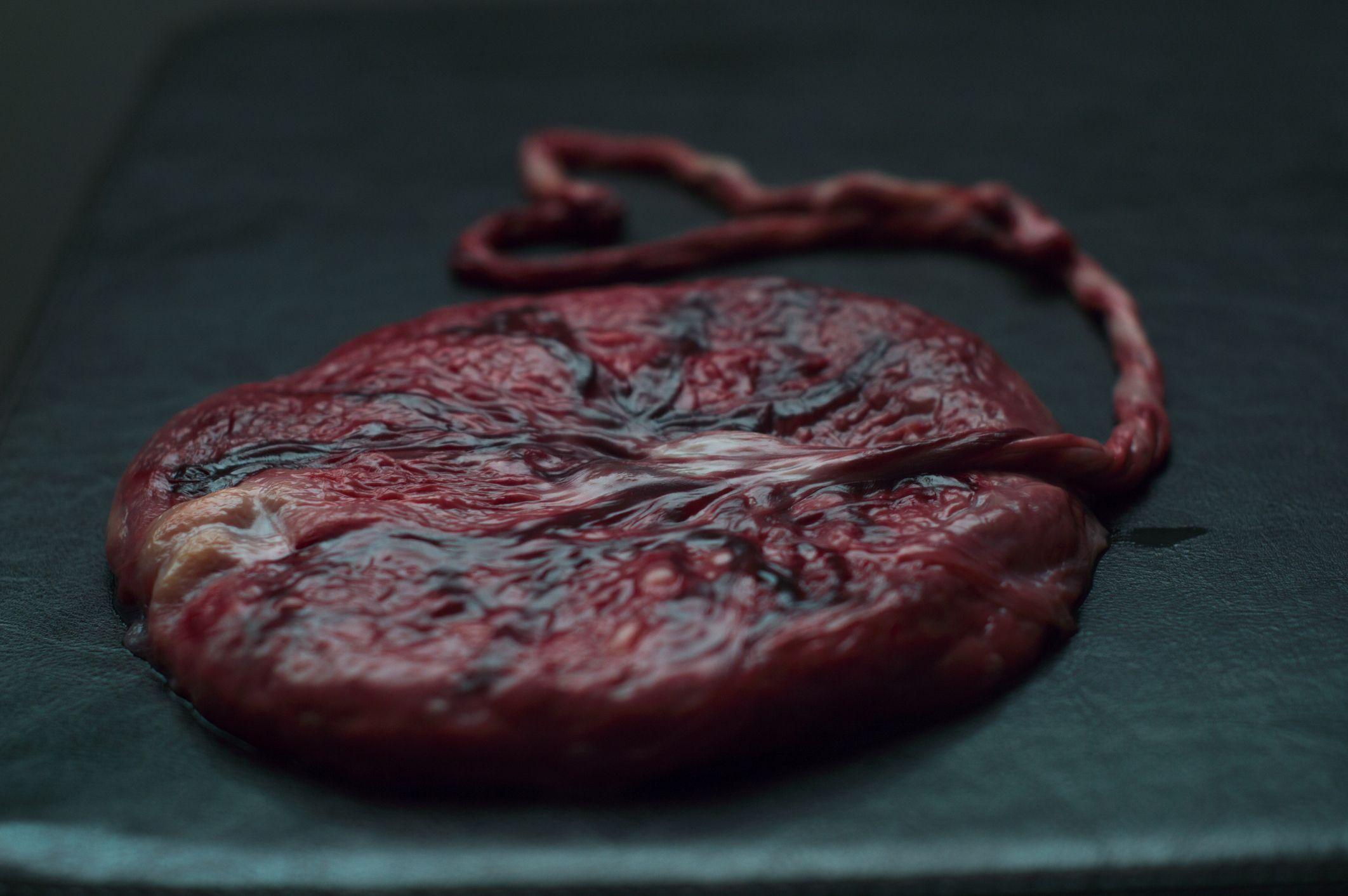Ljudska placenta