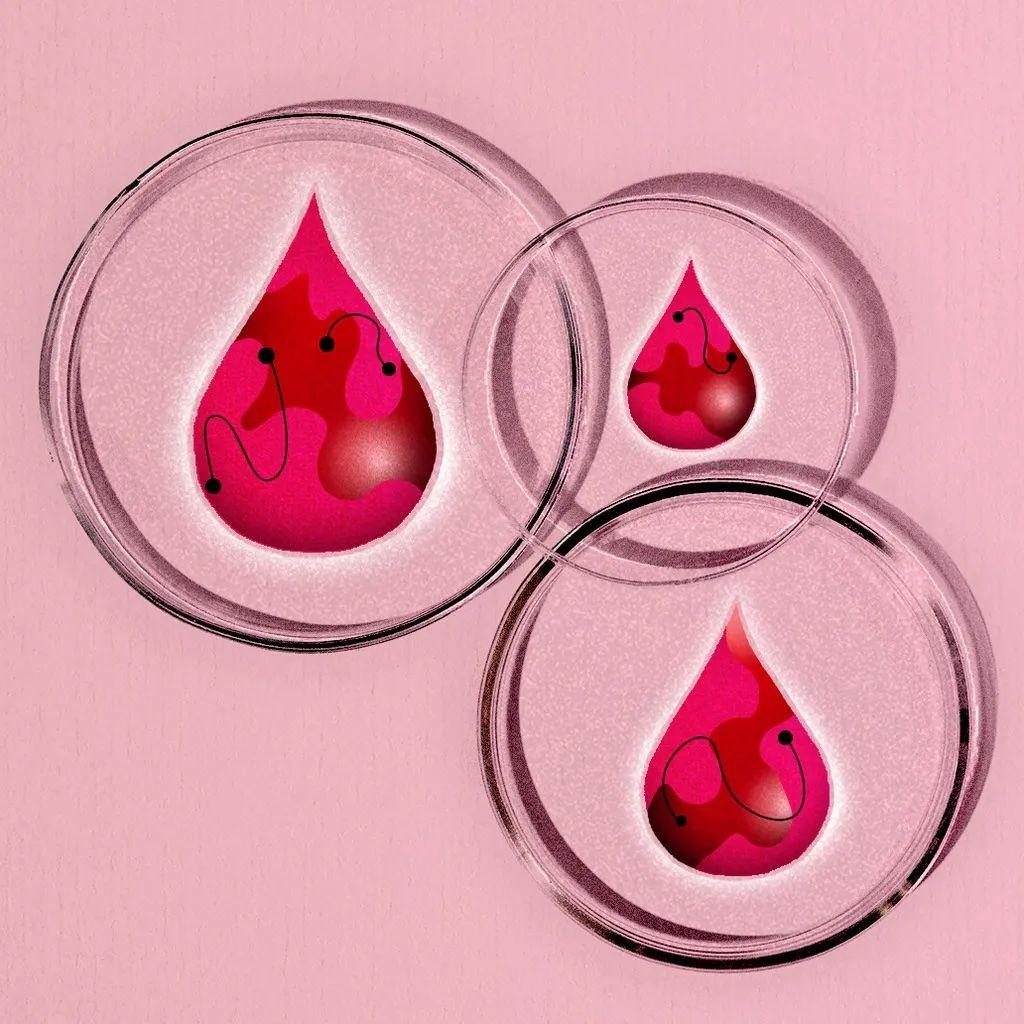 Grafika sa tri kapi menstrualne krvi. Proučavanje menstrualne krvi moglo bi biti korisno u predviđanju rizika od razvoja budućih stanja poput dijabetesa