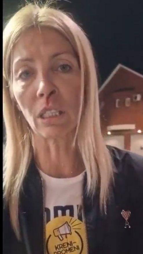 napadnuta odbornica Kreni-Promeni, Tanja Mićić, gradska odbornica Kreni-Promeni, koja tvrdi da ju je Šapić udario